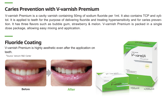 V-varnish Premium - 5% sodium fluoride, TCP and xylitol