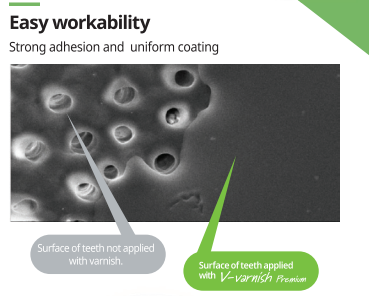V-varnish Premium - 5% sodium fluoride, TCP and xylitol