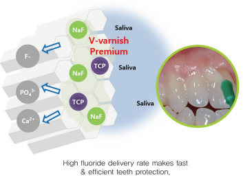 V-varnish Premium - 5% sodium fluoride, TCP and xylitol