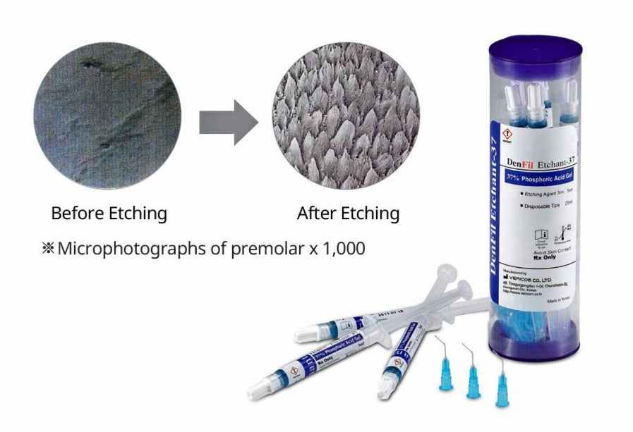 DenFil™ Etchant 37% Phosphoric Acid Gel