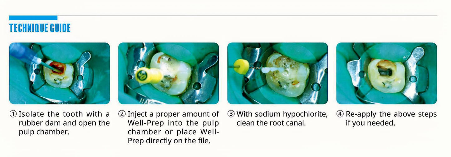 Well-Prep – EDTA Root Canal Cleaner