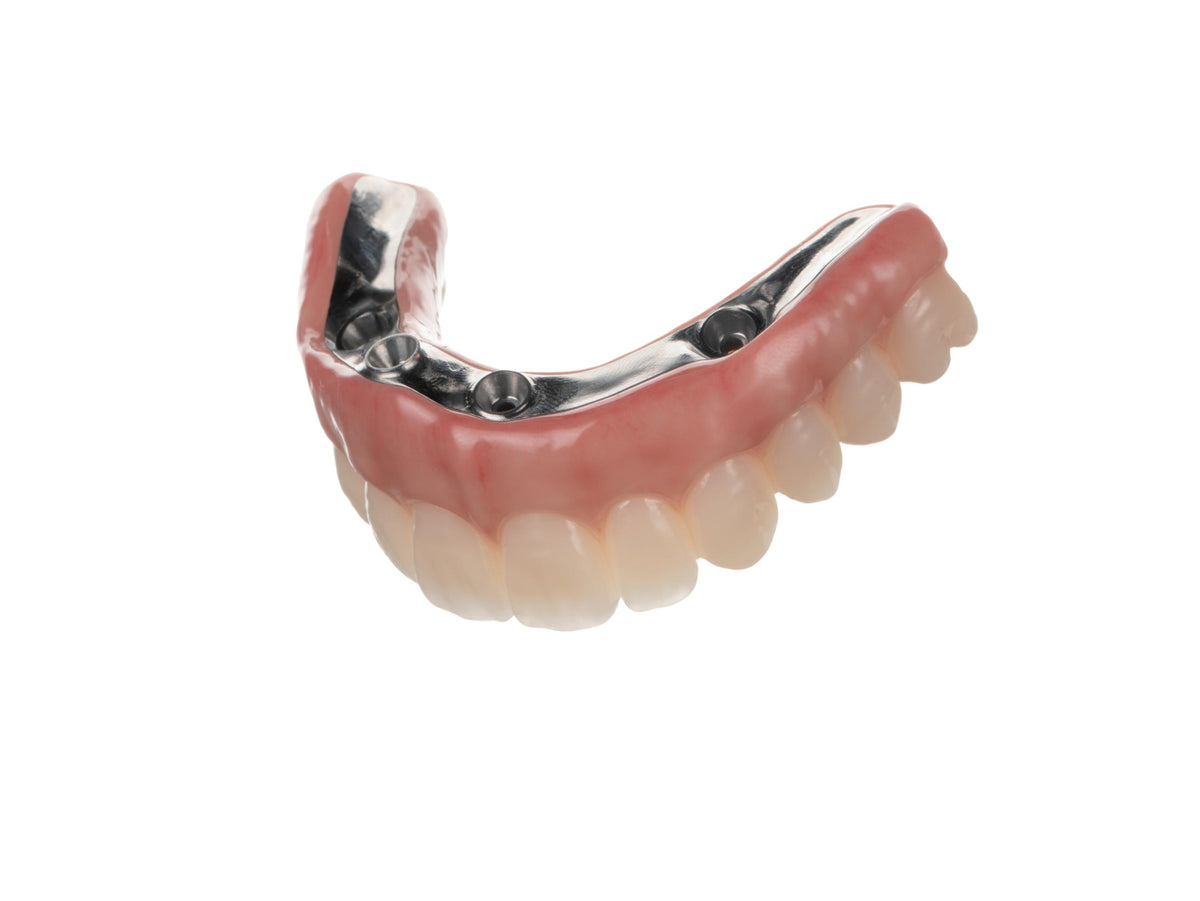 Full-arch restoration example from the Besmile 3D Aconia Master brochure; finished prosthesis and implant components not included