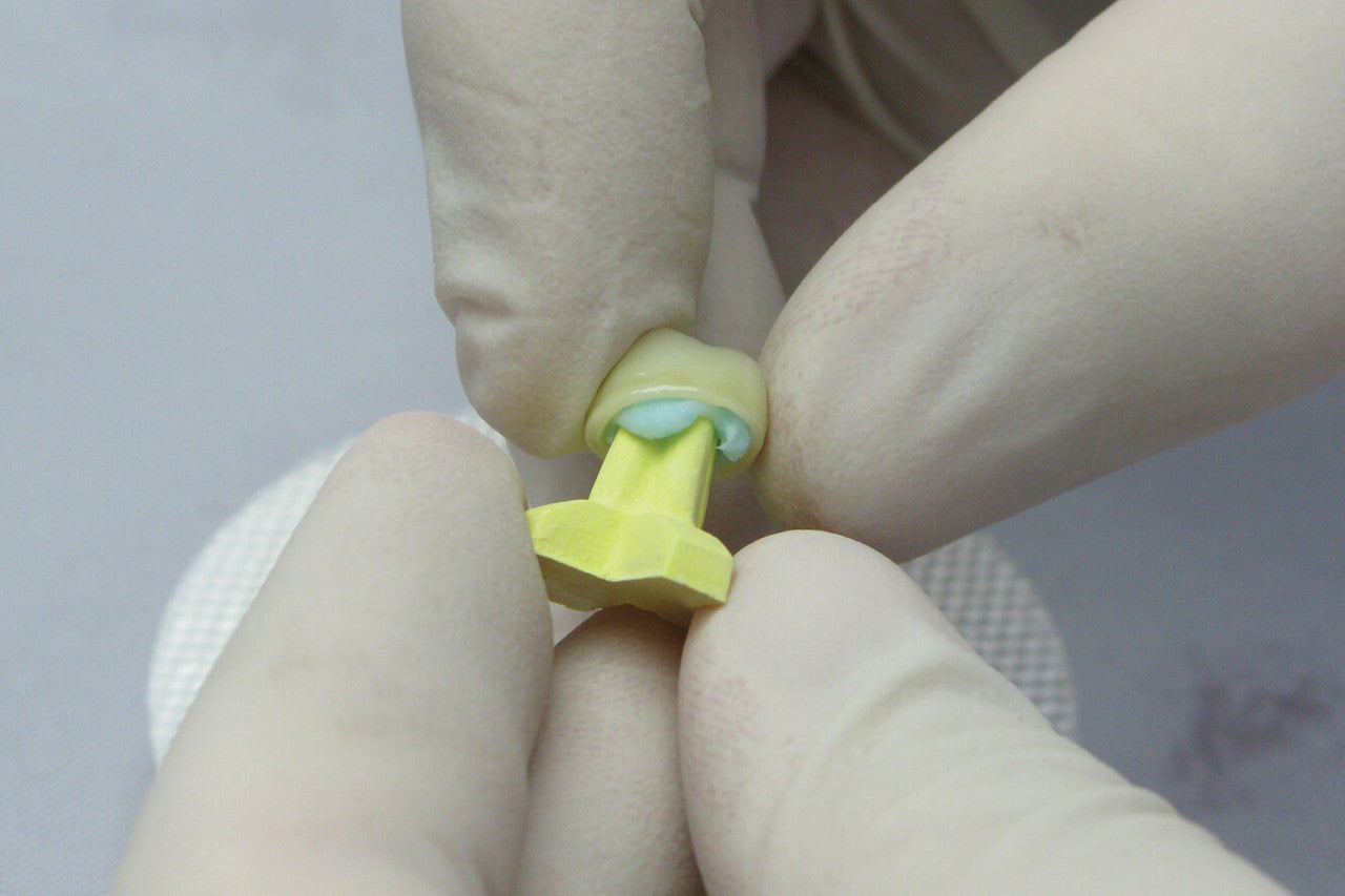 Vacalon Insta-Peg Refractory Peg Putty